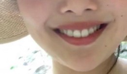 吃瓜大嘴女人视频大全,视频大全中的趣味瞬间