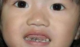 爆牙吃瓜搞笑视频合集,笑出腹肌的欢乐时光