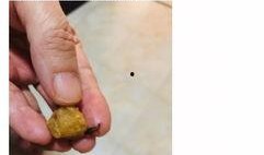 吃哈密瓜吃出虫的视频,一场意外的“虫虫大作战”